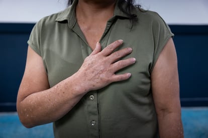 Una mujer de la Right to Freedom Network, en Miami, el 6 de septiembre.