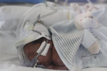 Un bebé prematuro, en el hospital de La Paz de Madrid.