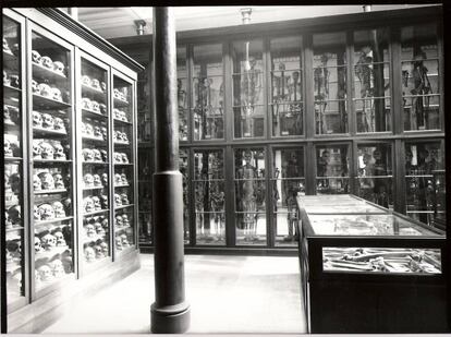 Colección de restos óseos humanos expuestos en el Museo de Ciencias Naturales de La Plata hasta 2006.