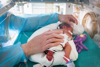 Un bebé prematuro.