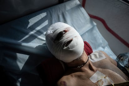 An injured Ukrainian soldier lies on a bed inside a special medical bus during an evacuation by volunteers from the Hospitallers paramedic organisation in Donetsk region, Ukraine