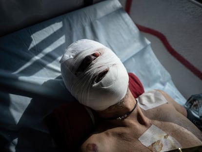 An injured Ukrainian soldier lies on a bed inside a special medical bus during an evacuation by volunteers from the Hospitallers paramedic organisation in Donetsk region, Ukraine