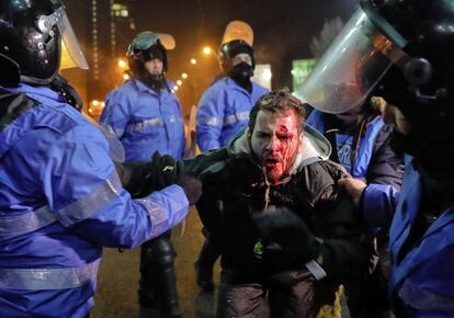 Antidisturbios rumanos detienen a un hombre con el rostro cubierto de sangre tras una protesta en Bucarest (Rumanía), el 2 de febrero de 2017. 