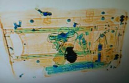 Imatge de l'escàner on es veu la sivella en forma de granada.