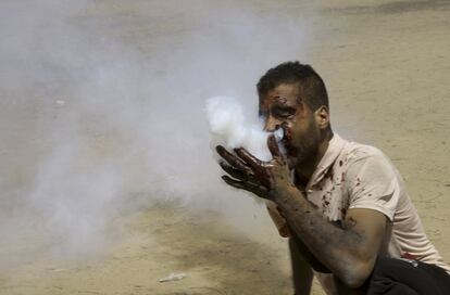 Un manifestante palestino exhala gas lacrimógeno tras ser impactado en la boca por un bote disparado por las tropas israelíes.