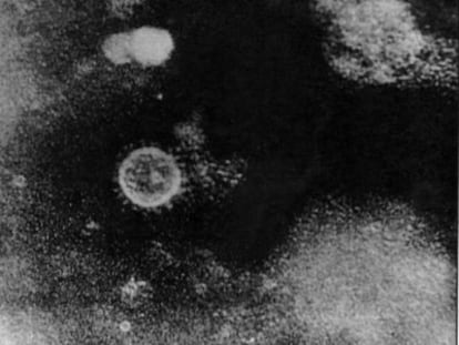 Imagen del virus de la hepatitis C.