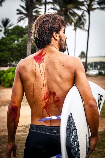 Aritz Aranburu cae surfeando en la playa de Haleiwa y se lesiona la espalda y el codo. Es la demostración de que el surf en Hawái tiene sus riesgos. Olas muy potentes, unas aguas en la que cubre muy poco y un fondo marino rocoso, fruto de la lava volcánica de la que se compone el terreno de estas islas.