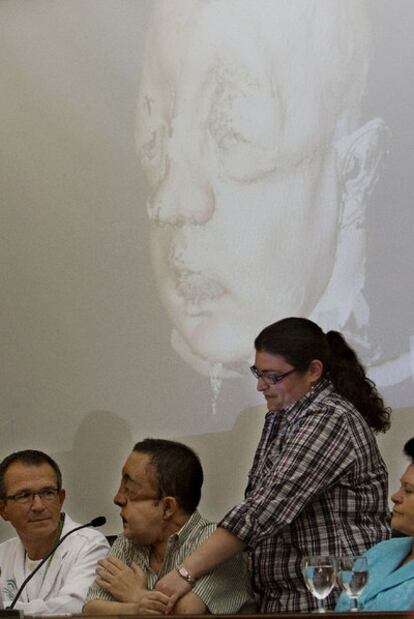 Rafael, el trasplantado de cara de Sevilla, quiso dar las gracias en público a la familia del donante.