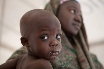 Madre e hijo, en una clínica de UNICEF cerca del campo de refugiados en Dikwa, Estado de Borno (Nigeria).