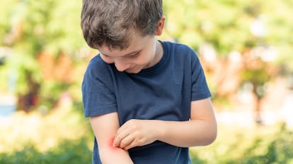 De la rabia a la aceptación: así se aprende a vivir con psoriasis