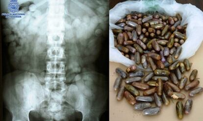 Los detenidos portaban bellotas de hachís dentro de su cuerpo.