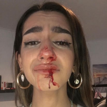 La joven transexual que ha sido agredida ha compartido su rostro golpeado.