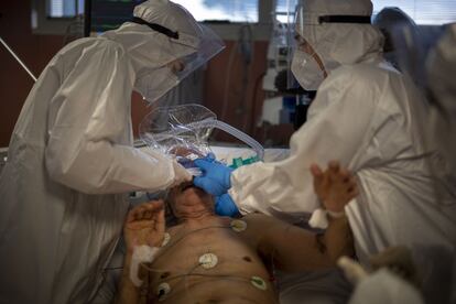 Personal sanitario coloca a un paciente con coronavirus un casco CPAP (presión de aire positiva continua), en la UCI del hospital Casalpalocco de Roma.