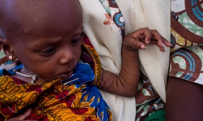 Yabissam, con malnutrición aguda severa es atendida en el asentamiento informal de Nguel Wanzam de Diffa, Níger.