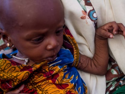 Yabissam, con malnutrición aguda severa es atendida en el asentamiento informal de Nguel Wanzam de Diffa, Níger.