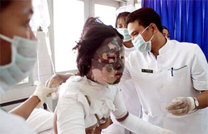 Un médico trata las quemaduras de una mujer herida en la explosión de Bali.
