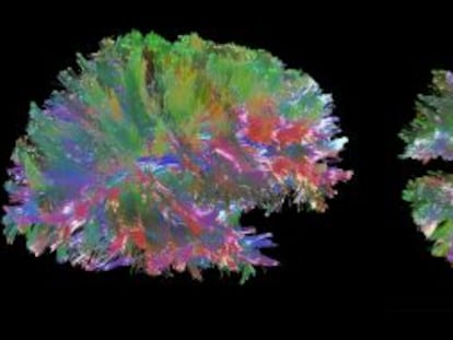 Mapa cerebral en 3D de MintLabs.