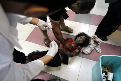 Una niña recibe atención médica en el hospital Al Shifa tras un ataque israelí, este domingo en Gaza.