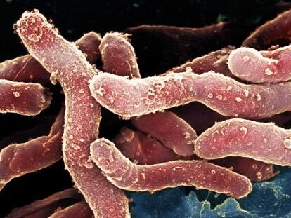 Fotograf&iacute;a de bacterias Helicobacter pylori.