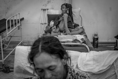 Kancha Lama Tamang fue herido en ambas piernas después de que su casa se derrumbase sobre él durante el seismo. Durante meses, Kancha Lama vive sin moverse en una cama dentro de un hospital de campaña creado por Médicos sin Fronteras en las afueras de Katmandú.