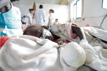 Nyan Deng, de 23 meses, fue hospitalizada con malaria grave, meningintis y ella estaba desnutrida. Se deshidrató a causa de la diarrea y su estado empeoró, por eso fue ingresada en la unidad de cuidados intensivos donde le han envualto las manos para evitar que se arranque la sonda nasogástrica.