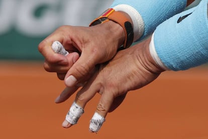 Nadal se duele del dedo corazón durante la final en París.