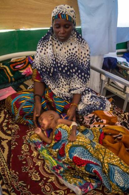 Una mujer cuida de su sobrino desnutrido, huérfano y seropositivo, en la unidad de desnutrición de Liwa (Chad).