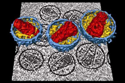 El virus del sida, en tres dimensiones.