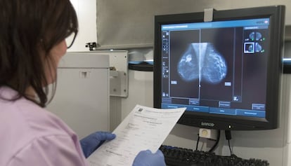 Médica examina uma radiografia de mama.