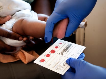 El primer escalón hacia una generacion libre de sida