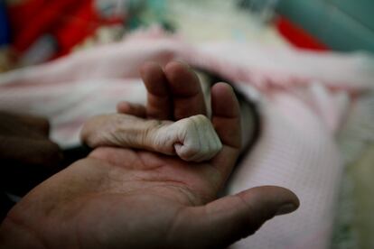 Saleh Hassan Al-Faqeh toma la mano de su hija de cuatro meses, Hajar, quien murió de desnutrición en la sala del hospital Al-Sabeen en Sanaa (Yemen), el 15 de noviembre de 2018. Fouad Al-Reme, una enfermera del hospital, dijo que Hajar estaba consciente cuando llegó al hospital, pero sufrió bajos niveles de oxígeno. Según estimaciones de la ONG Save the Children, alrededor de 85.000 niños menores de cinco años han podido morir a causa de la desnutrición en Yemen durante los tres años de guerra.