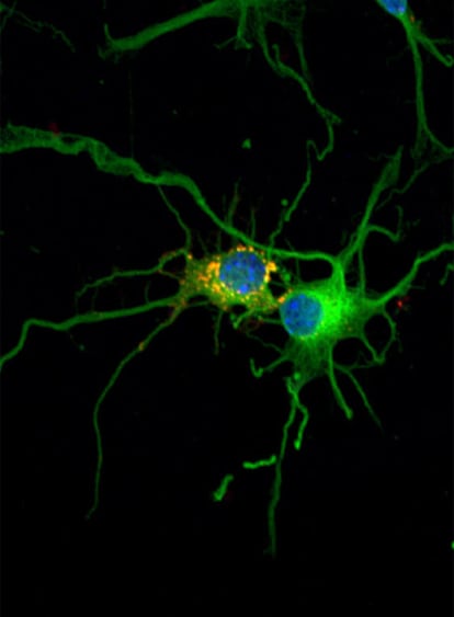Conexiones entre dos neuronas.
