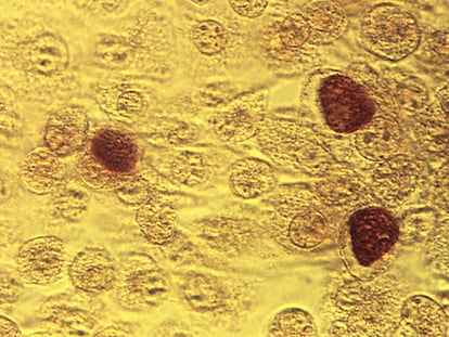 This 1975 microscope image made available by the the Centers for Disease Control and Prevention shows Chlamydia trachomatis bacteria.