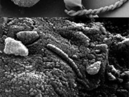 Estructuras helicoidales producidas en laboratorio vistas al microscopio electrónico.