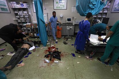 Personal sanitario trabajan este domingo en el hospital de Nasser tras un bombardeo israelí sobre Jan Yunis.