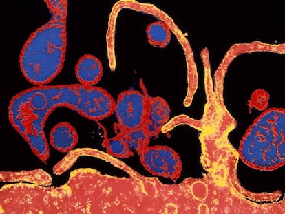 Microtograf&iacute;a electr&oacute;nica coloreada del virus de sarampi&oacute;n infectando una c&eacute;lula.