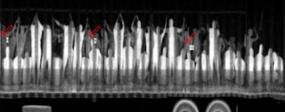 Uno de los caminones que transportaba a los inmigrantes, analizado por escáner.