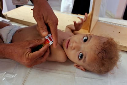 Se agota el tiempo para la infancia yemení. Casi 400.000 niños en el país padecen desnutrición aguda severa y las posibilidades de sobrevivir, alerta Unicef, son cada vez más escasas. "La rápida depreciación del rial yemení en los últimos meses ha agravado la crisis económica y ha provocado un aumento en los precios de los alimentos que pone a los niños en mayor riesgo", explica por correo electrónico Bismarck Swangin, especialista en Comunicación de Unicef en Yemen.