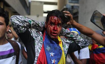 Manifestante é ferido em protesto em Caracas.