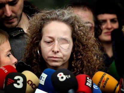 Ester Quintana, de 42 años, la mujer que perdió el ojo izquierdo durante las protestas registradas durante la huelga general del 14N.