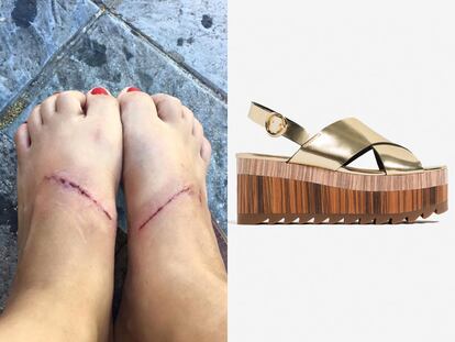 ¿Estas sandalias doradas de Zara provocan quemaduras en los pies?