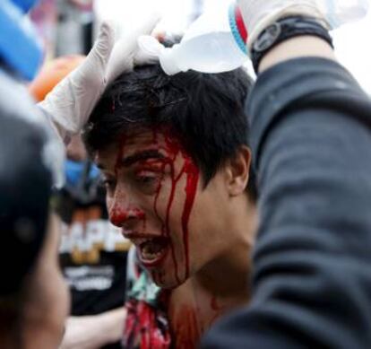 Manifestante ferido é atendido pelo Grupo de Apoio ao Protesto Popular (GAPP).