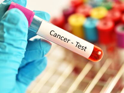 Ya existen biomarcadores para una treintena de tipos de cáncer, entre ellos, los de mayor prevalencia, como el colorrectal y los de mama, próstata, melanoma, ovario o pulmón.