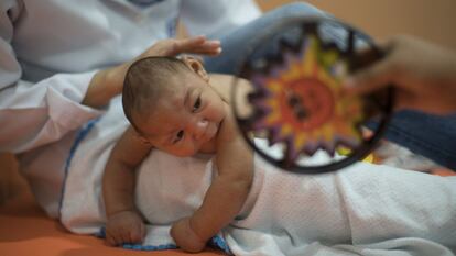 A baby born with microcephaly in Recife, Brazil.