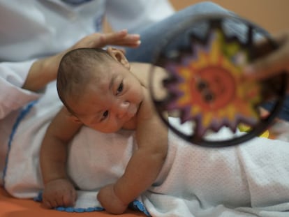 A baby born with microcephaly in Recife, Brazil.