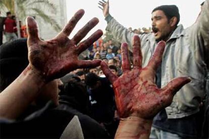 Un joven palestino muestra sus manos manchadas con sangre de las víctimas del ataque israelí en la ciudad de Gaza.