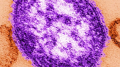 Apariencia estructural de una particula simple del virus del sarampión.