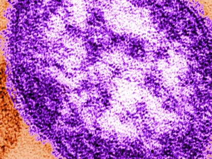 Apariencia estructural de una particula simple del virus del sarampión.
 