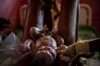 Um bebê recém-nascido, enquanto a enfermeira corta o cordão umbilical no Hospital Universitário de Bambari.