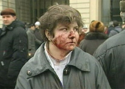 Una mujer con el rostro ensangrentado sale de la estación de metro donde se ha producido la explosión.
